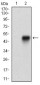 SYCP3 Antibody