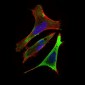 Ring1 Antibody