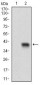 CD93 Antibody