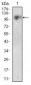 CD10 Antibody