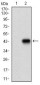 MEF2A Antibody