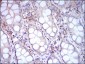 CD14 Antibody