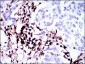 PTPRC Antibody