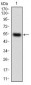 CSF1R Antibody