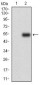 CSF1R Antibody