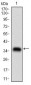 ABCB1 Antibody