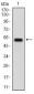 GABBR2 Antibody