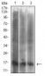 CDKN2A Antibody