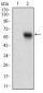 EPCAM Antibody