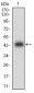 CNN1 Antibody
