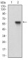 RAB27A Antibody