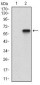 CD200 Antibody