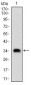 CSNK2B Antibody