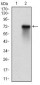 RPS6KA2 Antibody