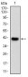 EIF5A Antibody