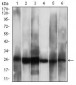 CSNK2B Antibody