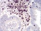 CD6 Antibody