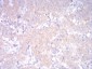 LDLR Antibody