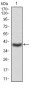 LDLR Antibody