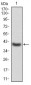 LDLR Antibody