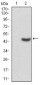 LDLR Antibody