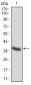 CTSD Antibody