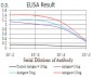 KDM5B Antibody