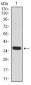 KDM5B Antibody