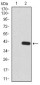 KDM5B Antibody