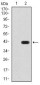 GAD2 Antibody