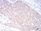 LRP1 Antibody