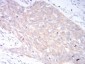 LRP1 Antibody