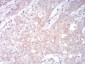LRP1 Antibody