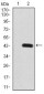 PDGFRB Antibody