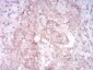 MMP14 Antibody