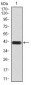 MMP14 Antibody