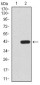 CBX2 Antibody