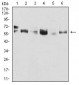 CK5 Antibody