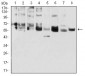 CK5 Antibody