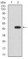 RAD52 Antibody