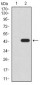 KDM4A Antibody