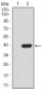 FBXL10 Antibody