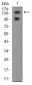 FBXL10 Antibody