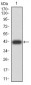 RAD52 Antibody