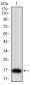 TSHB Antibody