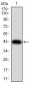 JARID2 Antibody