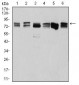 DDX3X Antibody