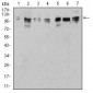 ULK2 Antibody