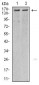 KDM6A Antibody