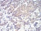 PLCG1 Antibody